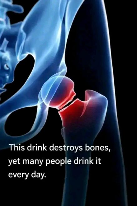 The five drinks that are most harmful to your bones, according to health experts.Full article 👇 💬